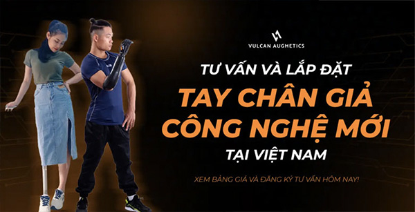 làm bàn chân giả ở hà nội