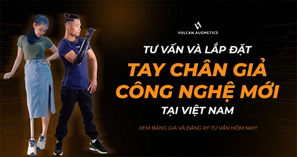 Phân Loại Các Loại Bàn Chân Giả Cho Từng Nhóm Đoạn Chi 