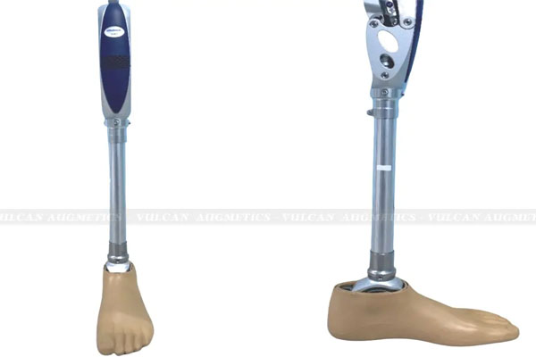 Phân Loại Các Loại Bàn Chân Giả Cho Từng Nhóm Đoạn Chi