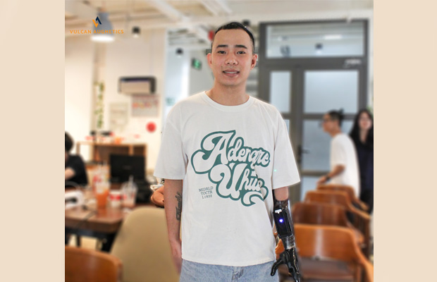 Vulcan Tài Trợ Tay Giả Điện Tử Miễn Phí Cho Người Dùng