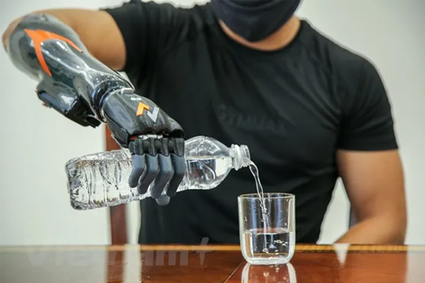 vai trò của việc lắp tay giả