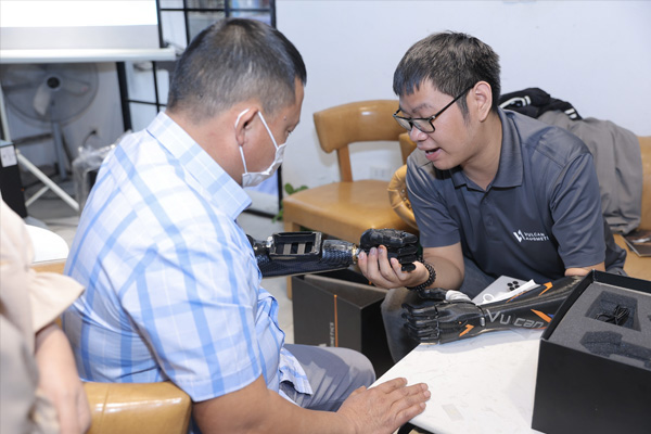 vai trò của việc lắp tay giả