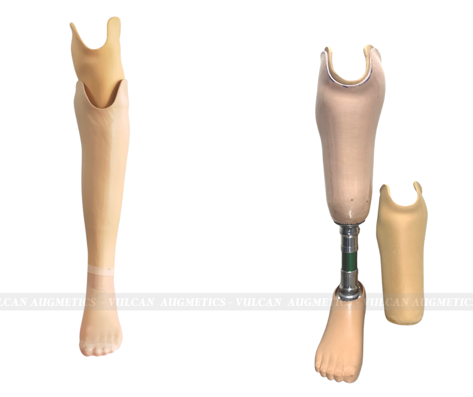 Chân giả dưới gối Socket mềm