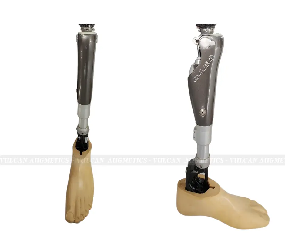 Chân giả trên gối C-Leg