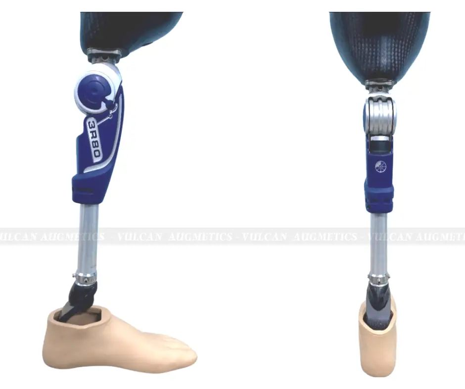 Chân giả trên gối - Khớp 3R80