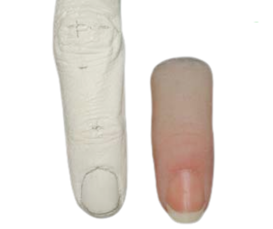 Ngón tay giả thẩm mỹ (Gia Công)