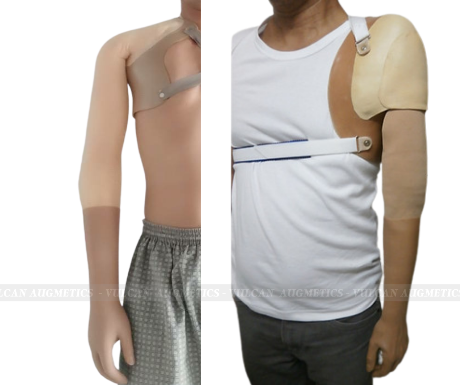 Tay giả tháo khớp vai