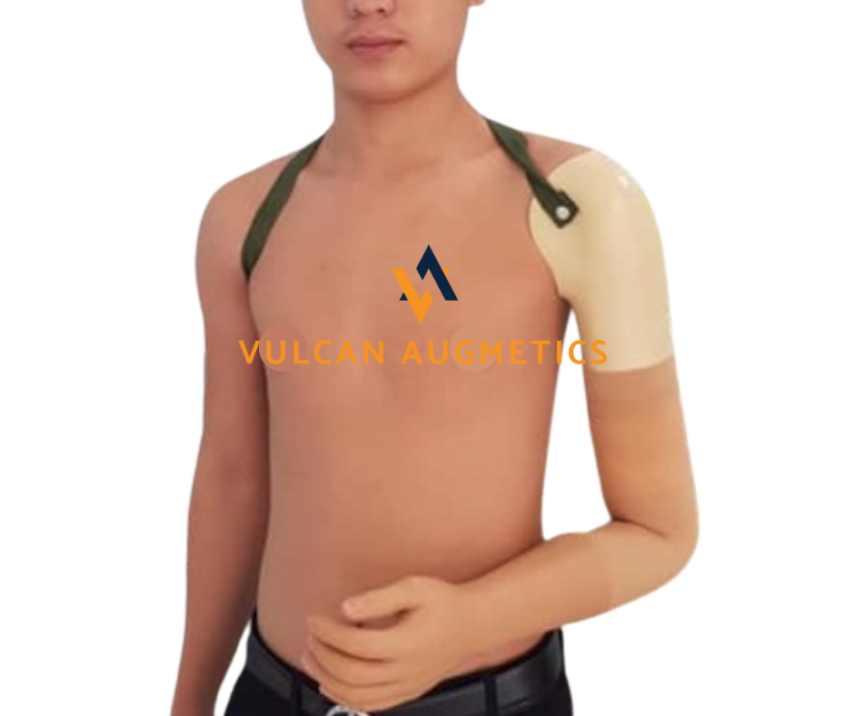 Tay thẩm mỹ trên khuỷu